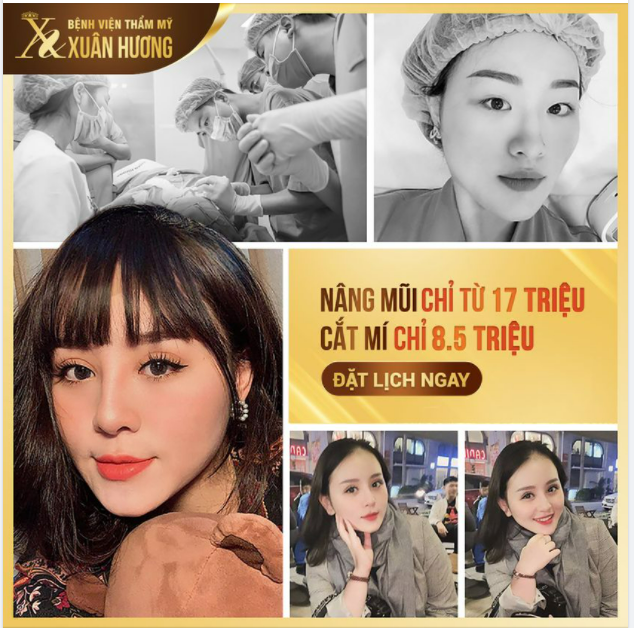 MẮT 2 MÍ THẦN THÁI - MŨI THANH THOÁT CAO SANG