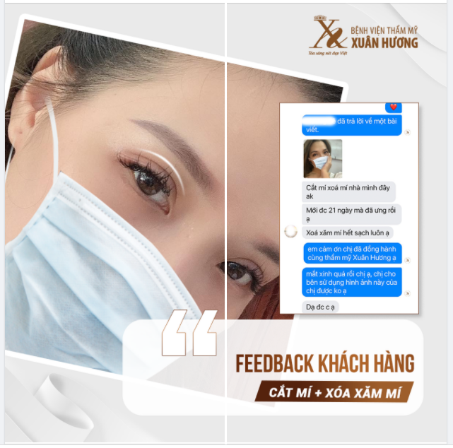 MÍ MẮT 21 NGÀY TUỔI - KHÁCH HÀNG ƯNG Ý - MÍ ĐẸP TỰ NHIÊN