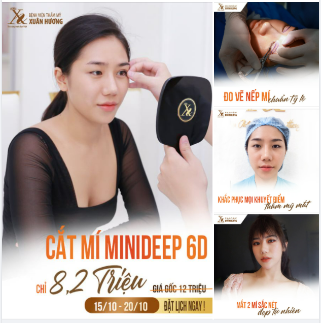 MÍ XINH, MẮT ĐẸP CUỐN HÚT CHỈ SAU 30 PHÚT CẮT MÍ MINIDEEP 6D