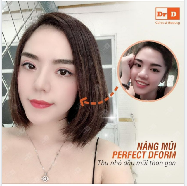 Mũi thấp tẹt thì dễ rồi. Nhưng mũi to thô thì làm sao?