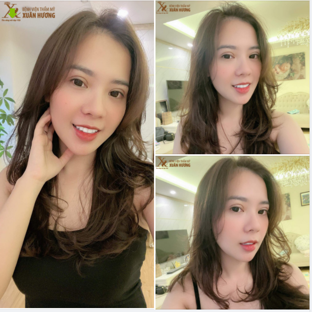 Muốn biết chất lượng dịch vụ tại BVTM Xuân Hương uy tín cỡ nào - Cứ nhìn phản hồi của khách hàng ưng ý là rõ!