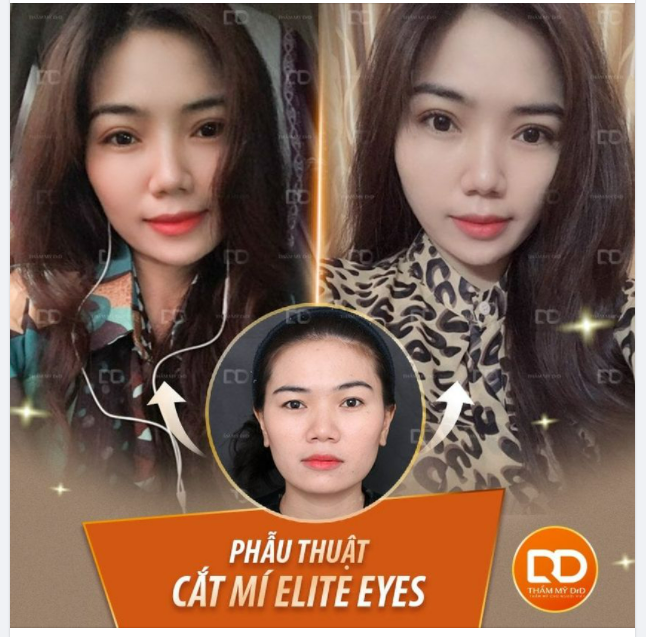 Muốn có một đôi mắt tươi trẻ mà chẳng biết chọn phương pháp nào cho tự nhiên?