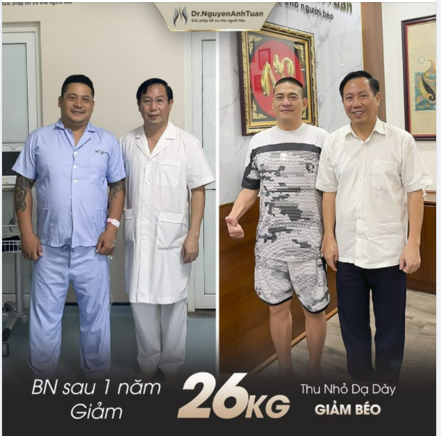 Nam bệnh nhân 40 tuổi, sau 1 năm thực hiện Thu nhỏ Dạ dày giảm 26kg (từ 103kg xuống 77kg)