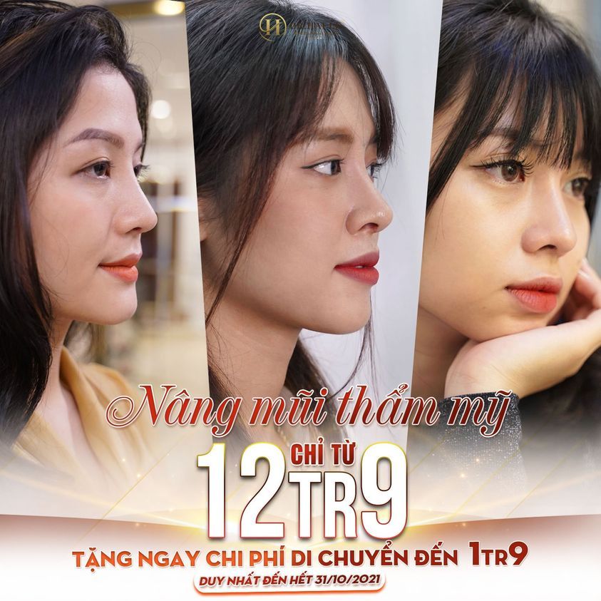 Nâng mũi cao sang rinh ngàn quà tặng tại Dr.Hải Lê