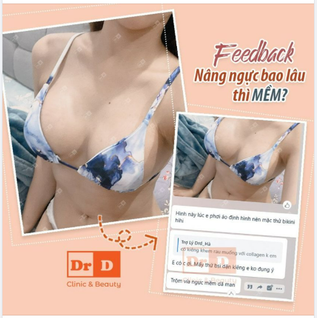 Nâng ngực Harmonic bao lâu thì mềm mại?