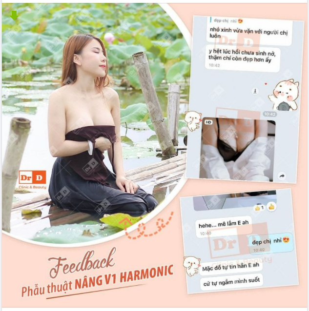 Nâng ngực xong có tự tin hơn không? ​​​​​​​Chắc chắn tự tin.