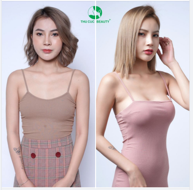 NÂNG V1 HÔM NAY - NHẬN NGAY ƯU ĐÃI KHỦNG