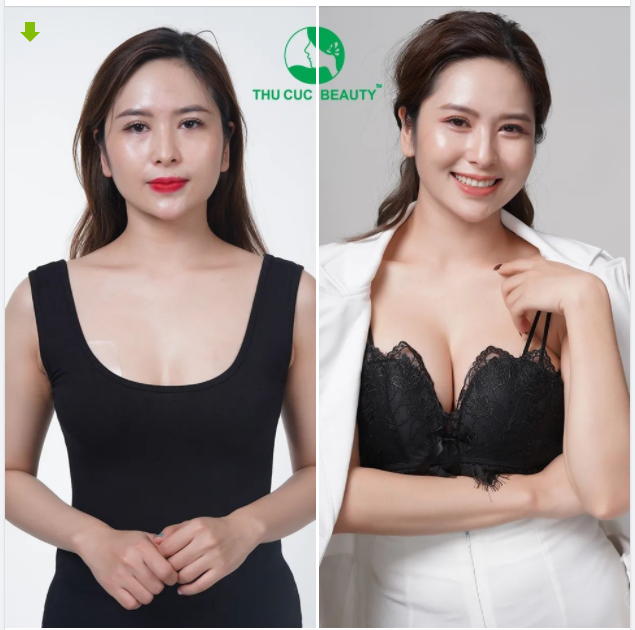 NÂNG V1 TẠI THU CÚC  NHÌN LÀ ''ĐẮM'' - NGẮM LÀ ''MÊ''