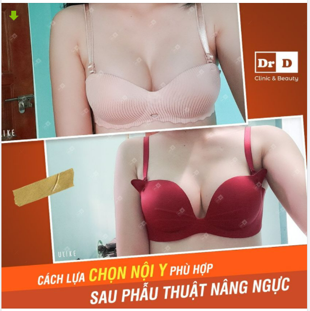 Nâng ngực sau 2 tháng, tầm này thì có thể bỏ áo định hình và thoải mái diện những chiếc bra yêu thích rồi.