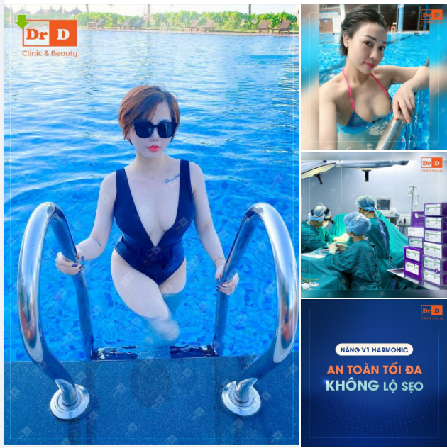 Những lý do nên lựa chọn nâng V1 Harmonic tại DrD.