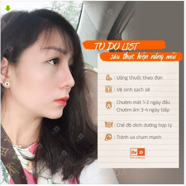 Nói mãi rồi nhưng các "chiếu mới" vẫn đang còn lạ lẫm về "To do list" nên và không nên làm sau phẫu thuật nâng mũi.