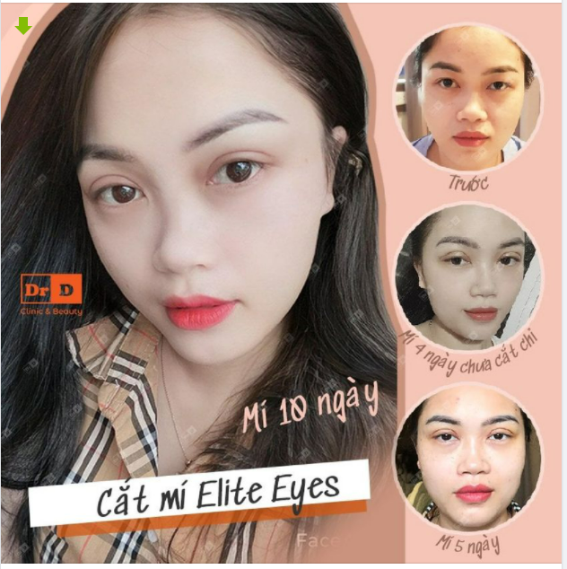 Nói thật đi, nhìn mí mắt này bạn có mê chữ ê kéo dài?