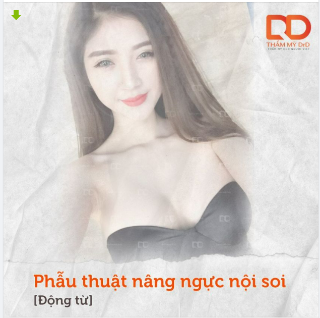 Phẫu thuật nâng ngực nội soi là gì?