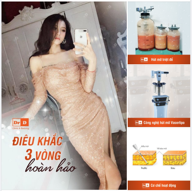 Phòng GYM đóng cửa, thức ăn nạp vào nhiều hơn. May mà vẫn còn có công nghệ HÚT MỠ VASERLIPO