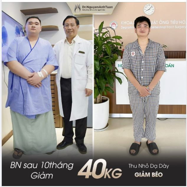 "Phương pháp Thu nhỏ Dạ dày Giảm béo" kết hợp với một Chế độ dinh dưỡng hợp lý – Hoạt động thể thao điều độ - Cân bằng lối sống lành mạnh giúp bạn có một vóc dáng cân đối và một cơ thể khỏe mạnh