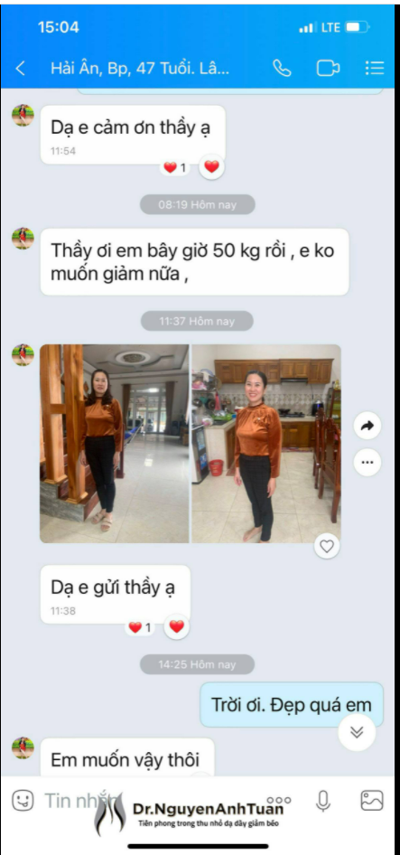 Phương pháp Thu Nhỏ Dạ Dày giảm béo Khoa học - An toàn - Hiệu quả - Bền vững