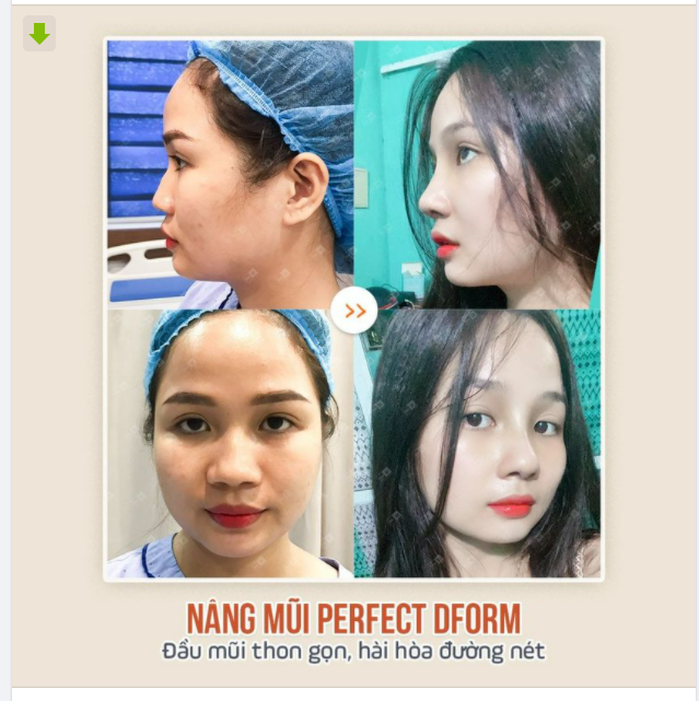Sau bao lần đắn đo có nên nâng mũi, cuối cùng cũng hạ quyết tâm. Rồi cũng có những thứ cần thay đổi để trở thành phiên bản hoàn hảo hơn của chính mình.