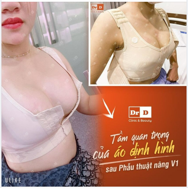 Sau nâng ngực em không mặc áo định hình được không?