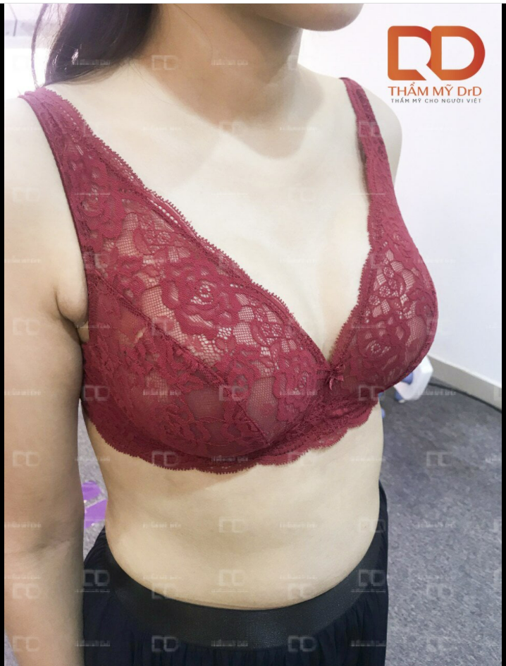 Sở hữu số đo vòng 1 lý tưởng không khó. Bạn chỉ cần muốn, còn lại để DrD lo nhé.