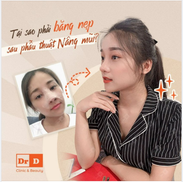 Tại sao phải băng ép cố định sau khi phẫu thuật nâng mũi?