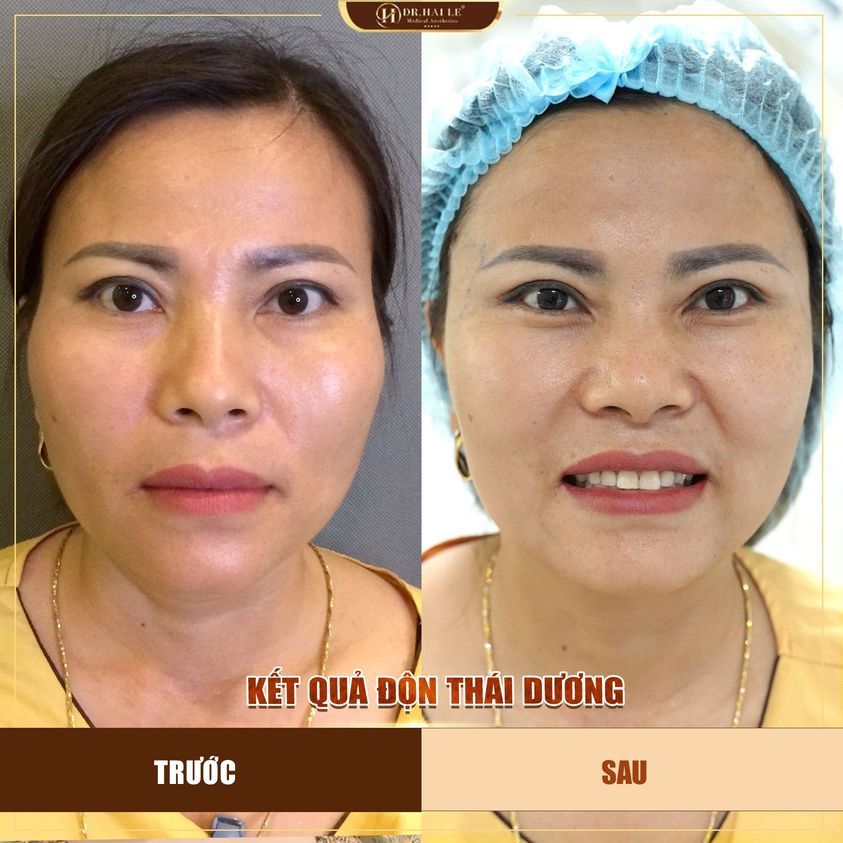 THAY ĐỔI TƯỚNG MỆNH NHỜ ĐỘN THÁI DƯƠNG!