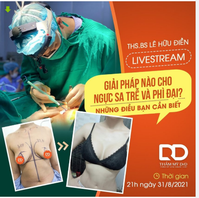 Tiếp tục tuần mới, 1 livestream mới với chủ đề cực hấp dẫn cùng ThS.BS Lê Hữu Điền: "Giải pháp nào cho ngực sa trễ và phì đại. Những điều bạn cần biết."