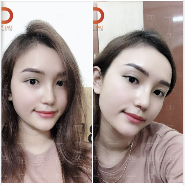 Tranh thủ thời gian nghỉ Tết COVID, dáng mũi đẹp thế này ngại gì mà không khoe các nàng nhỉ.