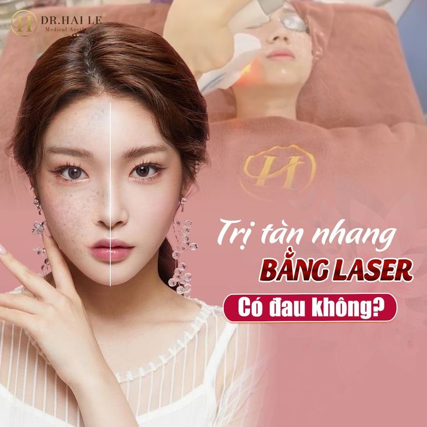 Trị tàn nhang bằng laser có đau không? Câu trả lời là KHÔNG.