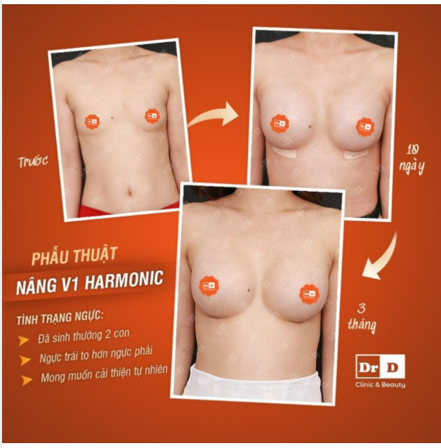 Trong quá trình thăm khám và tư vấn, DrD luôn lắng nghe mong muốn của khách hàng để biết mọi người đang muốn gì, cần gì để đưa ra những lựa chọn phù hợp nhất.