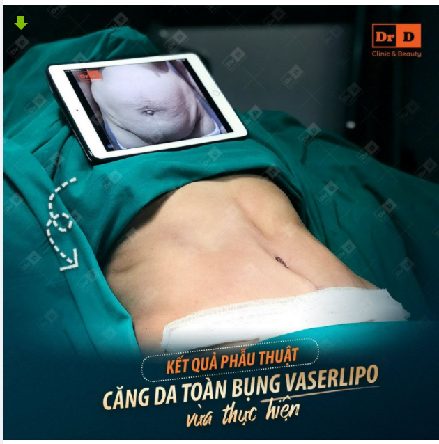 Từ hôm nay trở đi, bạn sẽ không cần bàn đến chuyện cần phải loại bỏ mỡ ra khỏi cơ thể nữa.