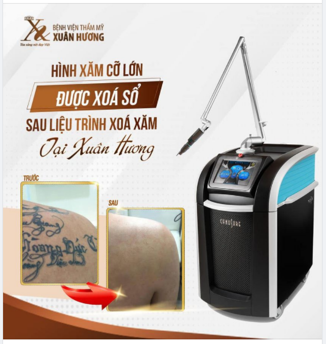"TƯỞNG XÓA XĂM KHÓ MÀ KHÔNG NGỜ KẾT QUẢ CÒN HƠN MÌNH MONG ĐỢI"