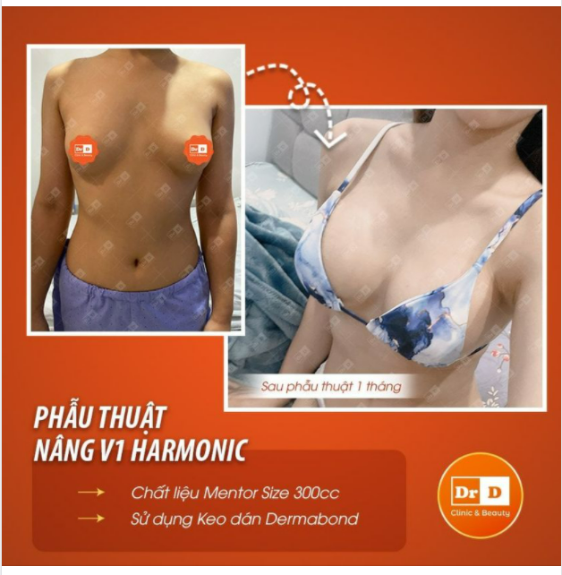 Tuy Mentor không "cao" nhưng người khác cũng phải ngước nhìn.