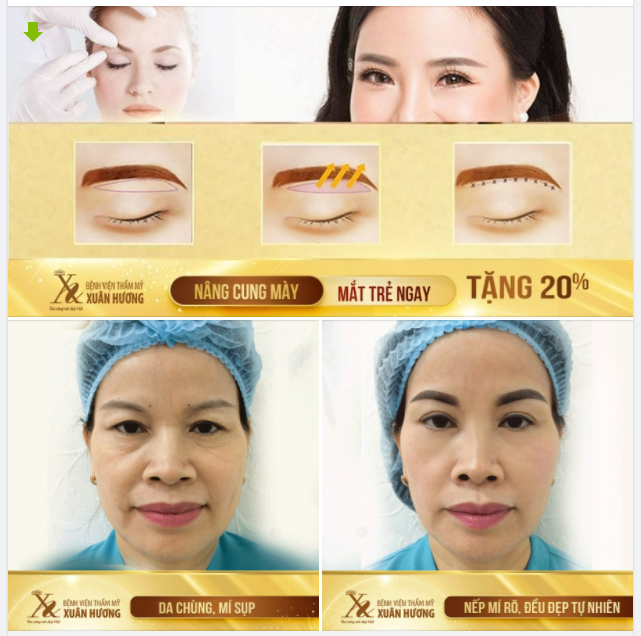 U50 "HỒI XUÂN" TRẺ RA CẢ CHỤC TUỔI NẾU BIẾT BÍ KÍP NÀY