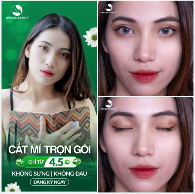 ƯU ĐÃI CỰC HOT - CẮT MÍ TRỌN GÓI