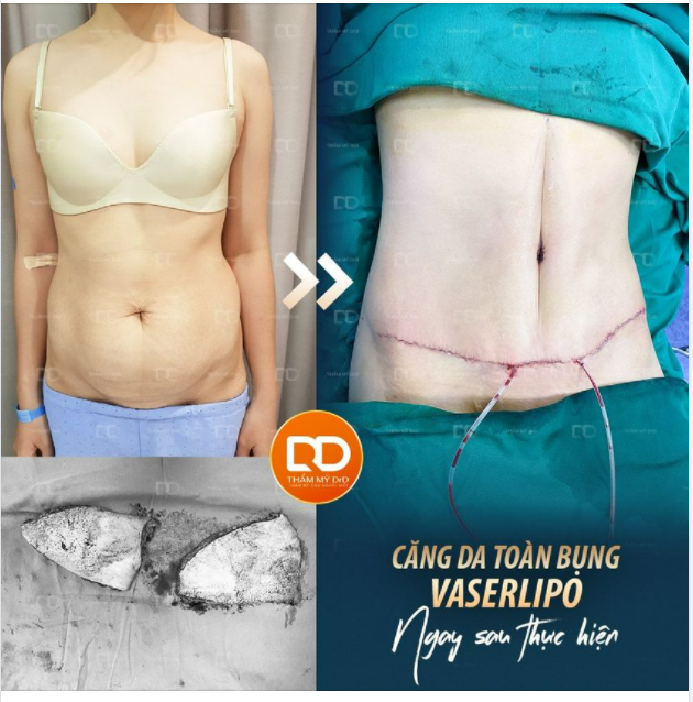 Vẫn là "người ấy" nhưng vòng eo thon gọn hơn.