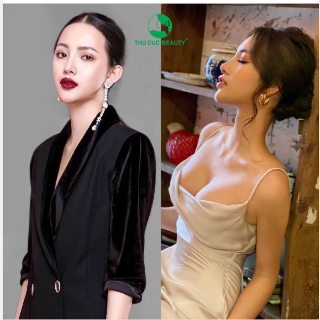 VĨNH BIỆT TEO LÉP - ĐÃ NÂNG LÀ ĐẸP