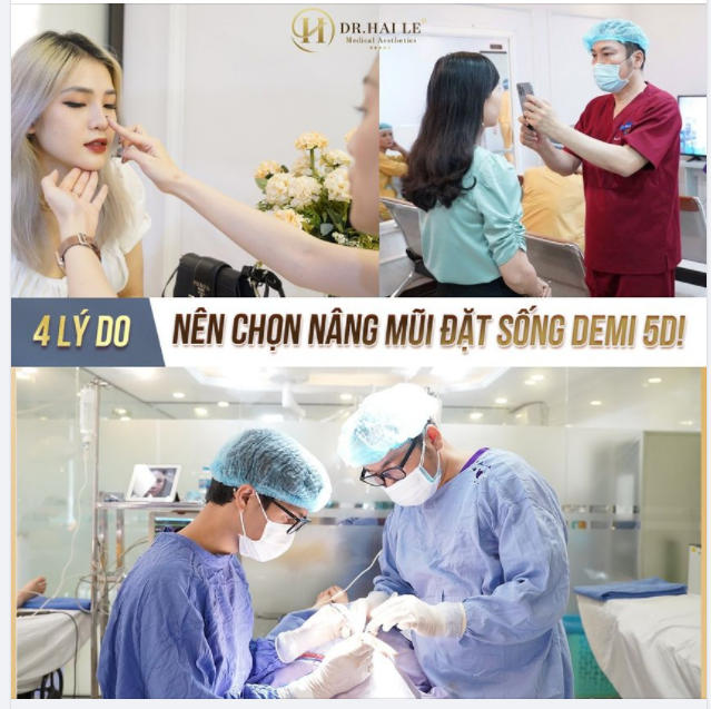 4 LÝ DO NÊN CHỌN NÂNG MŨI ĐẶT SỐNG DEMI 5D
