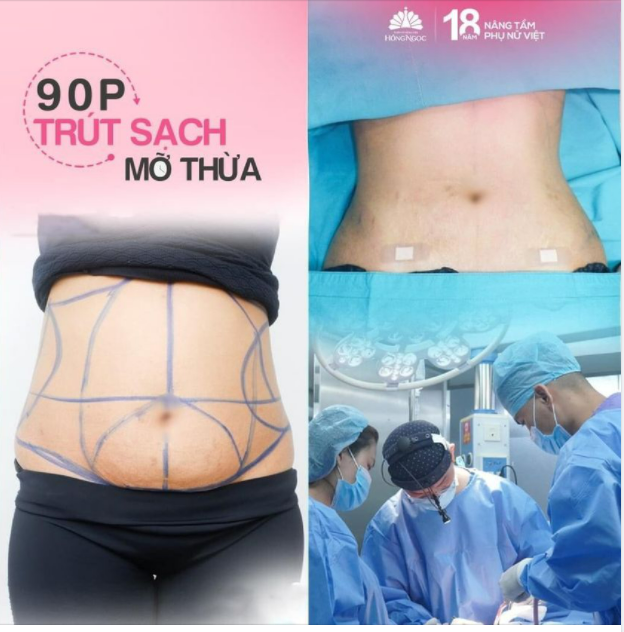 90P SẠCH MỠ - SIẾT CƠ - EO THON HẾT CỠ