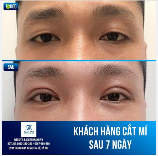 Ai cũng có nhu cầu làm đẹp và đều có thể làm đẹp !