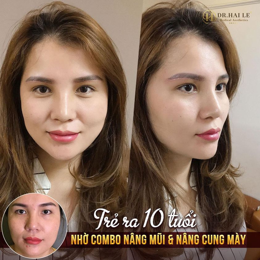 ​​​​​​​"AI GẶP CŨNG BẢO CHỊ 35 MÀ CỨ NHƯ 45"