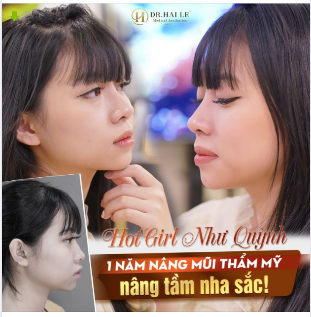 Anh ơi uống rượu làm chi Nhìn em một lúc kiểu gì chẳng say!