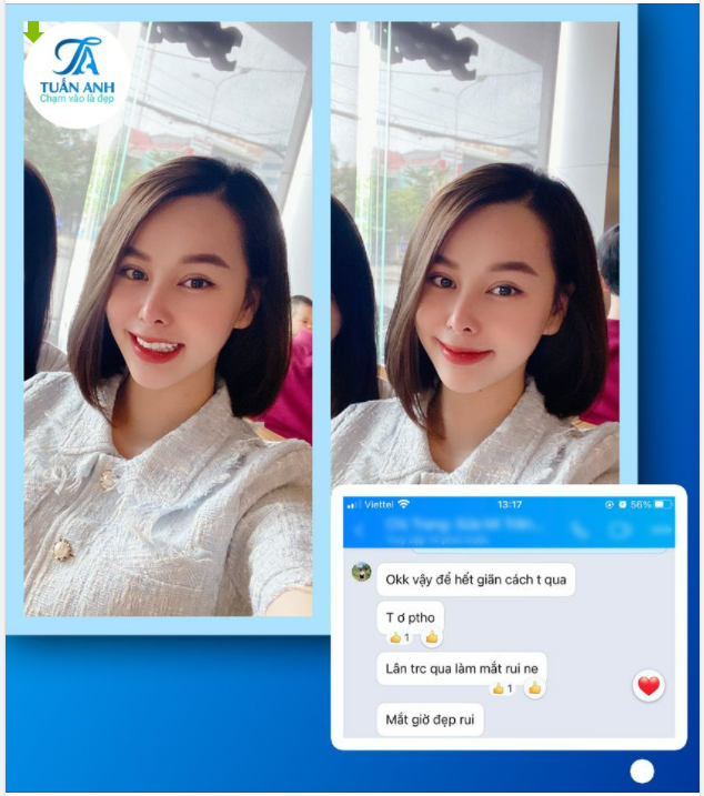 ​​​​​​​''Bác sĩ Tuấn Anh mát tay thật đấy, mắt mình cắt mí bị hỏng đến bác sĩ sửa lại giờ đẹp ưng dã man, ai cũng khen đẹp với xinh ra hihi''