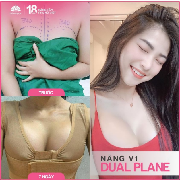 BẠN CÓ TÒ MÒ SAU 7 NGÀY NÂNG CẤP V1 DUAL PLANE SẼ THAY ĐỔI NHƯ THẾ NÀO? LIỆU CÓ ĐAU NHƯ BẠN NGHĨ?