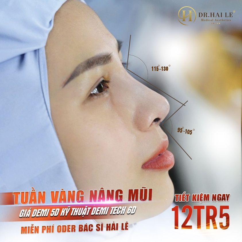 Bạn đã biết tin gì chưa? Chỉ còn 2 ngày nữa là kết thúc TUẦN VÀNG NÂNG MŨI - Mũi đẹp - Giá xịn. NHANH TAY KẺO LỠ!