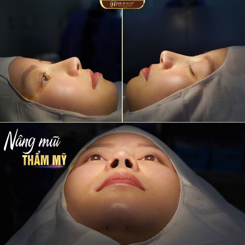 BẠN HÃY TRAO CHO DR.HẢI LÊ NIỀM TIN - DR.HẢI LÊ SẼ TRAO CHO BẠN SỰ TỰ TIN