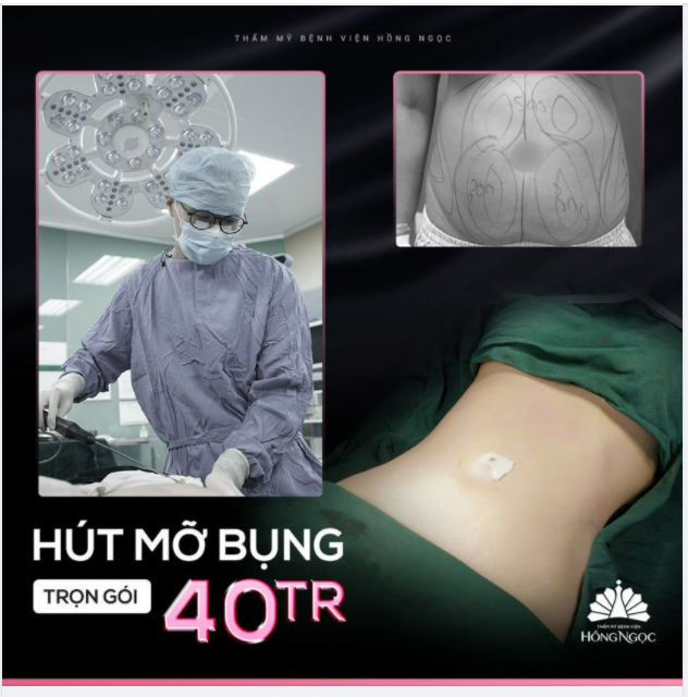 BỤNG GỌN EO THON TRÔNG MÒN CON MẮT