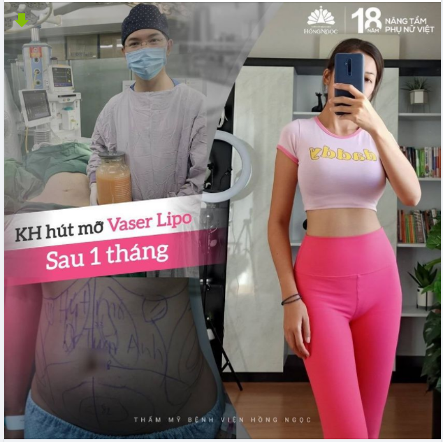 BỤNG SIZE L SAU 1 GIỜ HÓA XS