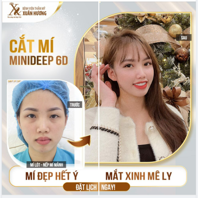 CẮT MÍ XONG TRẺ XINH HƠN LÀ CÓ THẬT!