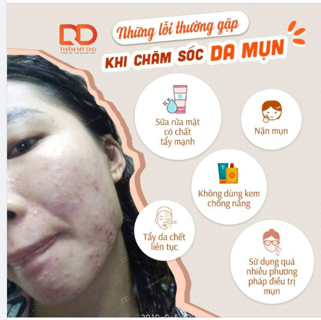 Chăm da mụn không khó nhưng nếu không chăm sóc đúng đủ thì da rất dễ tổn thương, mụn có thể lên dày đặc, để lại thâm sẹo và rất khó phục hồi.