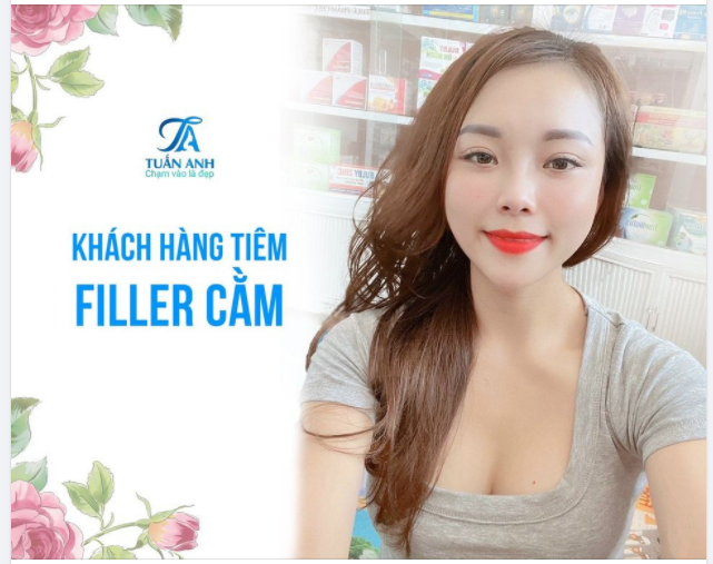 CHỈ 10P CÓ NGAY CHIẾC V-LINE XINH XẮN